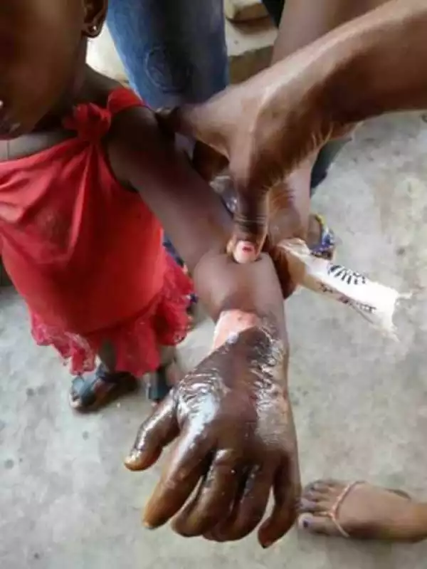 See What A Mother Did To Stop Her Daughter From Sucking Her Fingers [photo]
